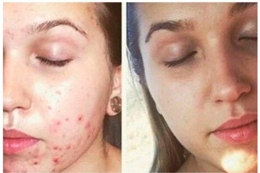 Resultado de Natalia